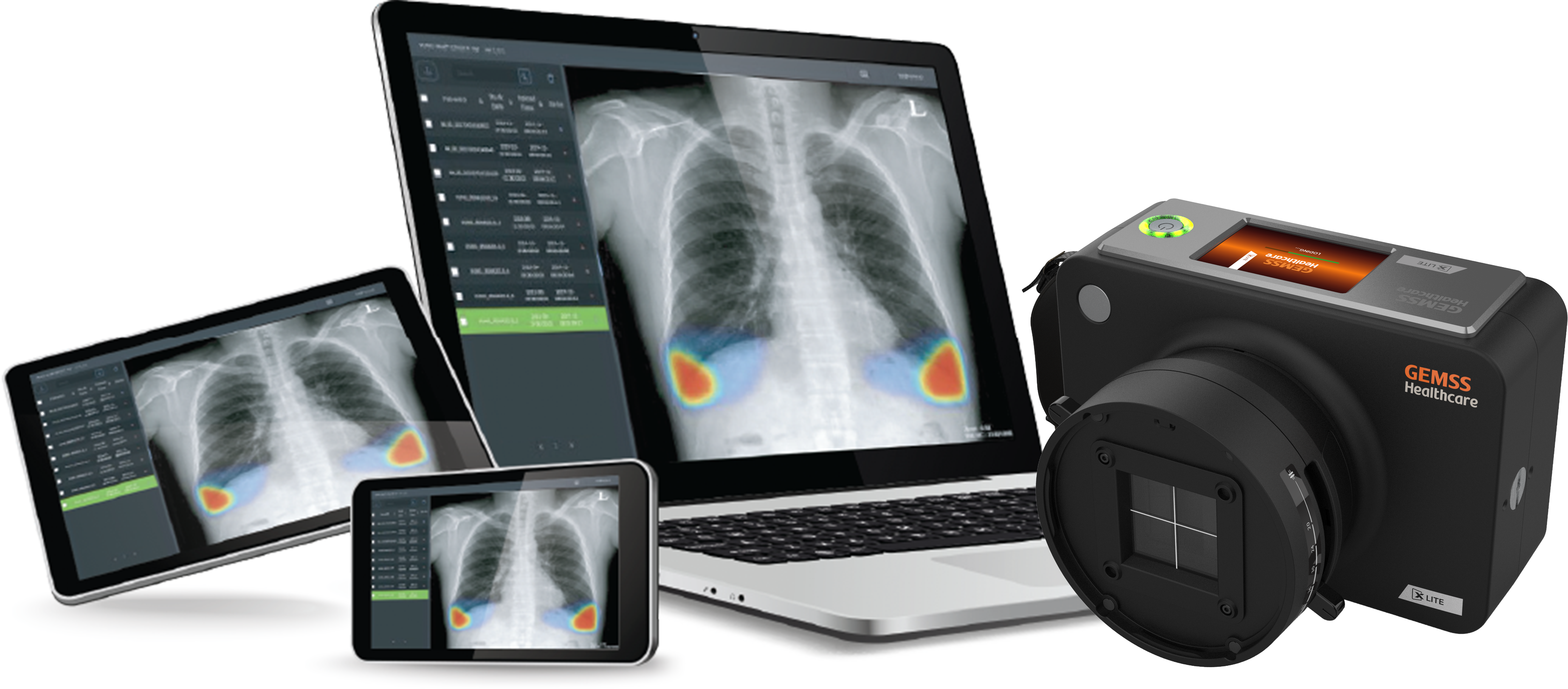 XLITE (Ultra-Lightweight Portable X-ray) Image 1